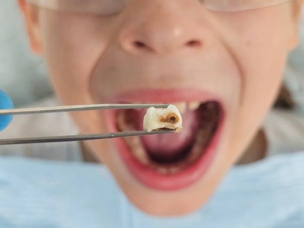 Best Knocked-Out Tooth Emergency  in Santo Domingo Pueblo, NM